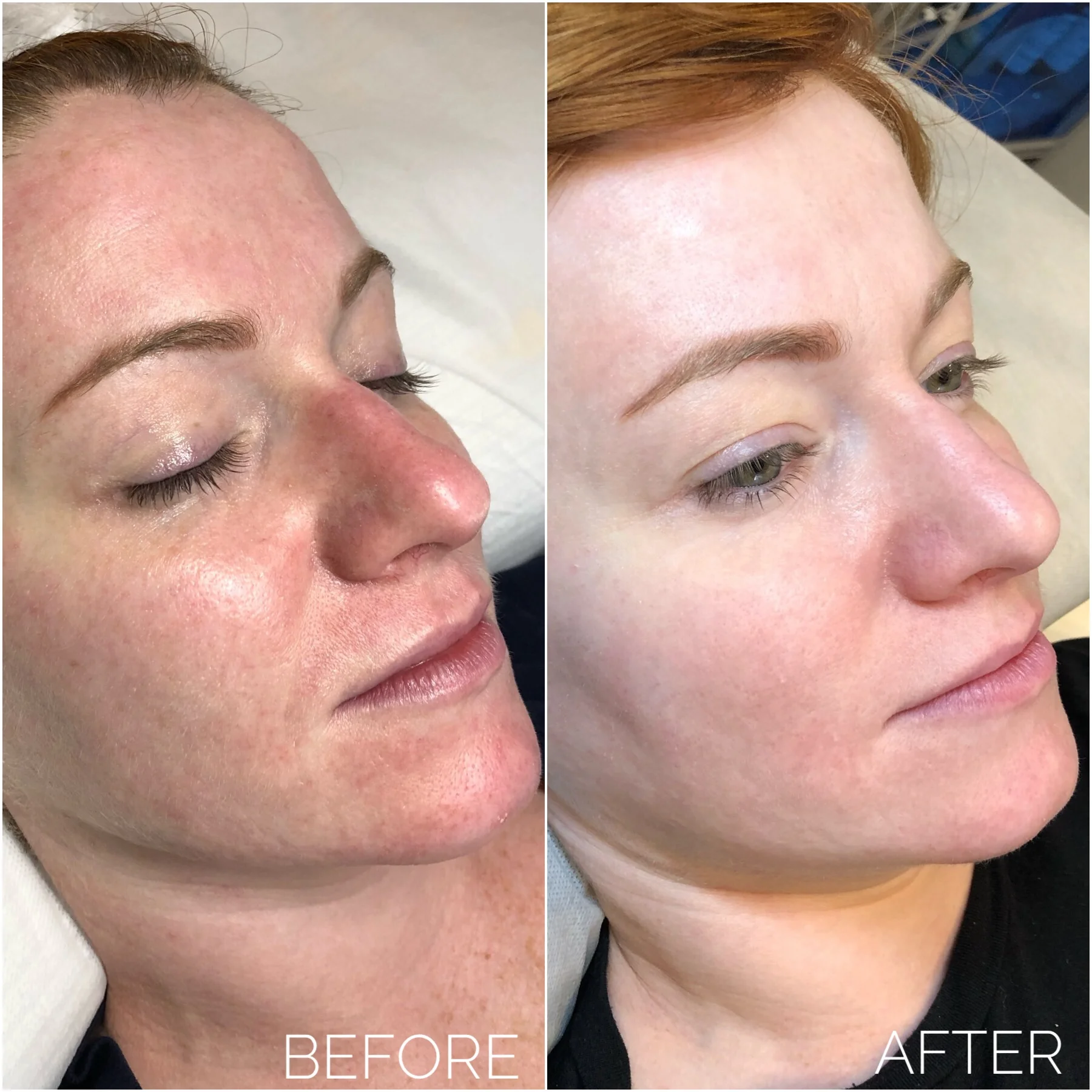 Bb glow facial deals